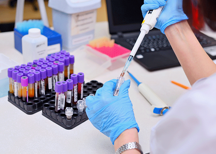 Why You Should Take ALA For Cellular Energy