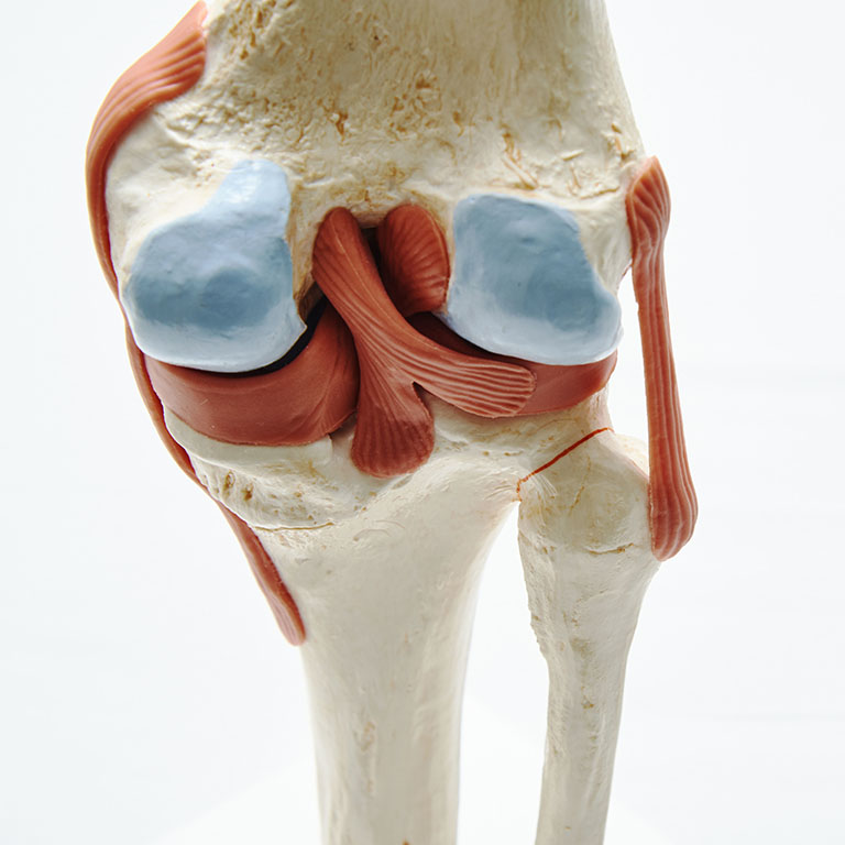 Dr. Meredith Warner On Knee Arthritis - Knee Model