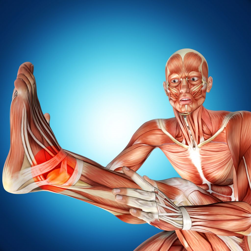 What Is The Fascia Kinetic Chain - Illustration of Ankle Injury