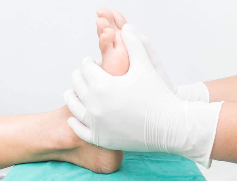 What is Hallux Rigidus?