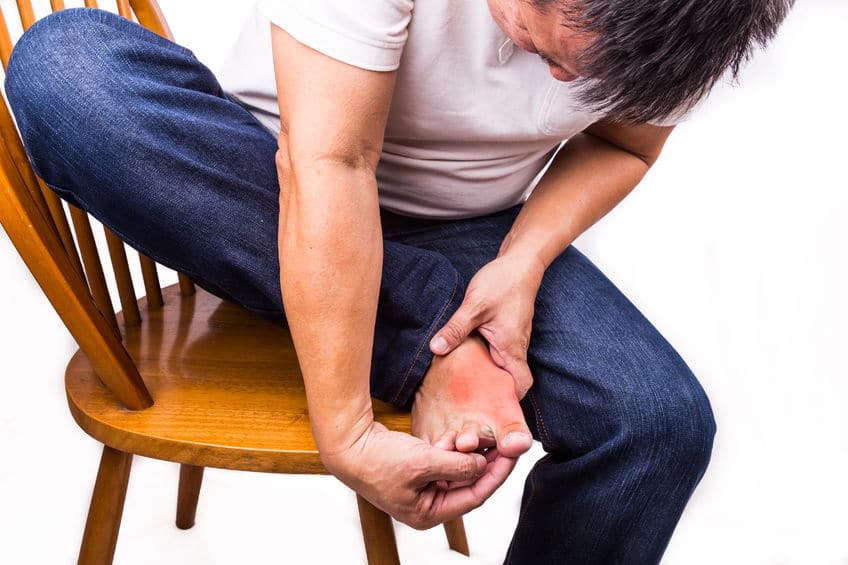 How to Prevent and Treat Gout Flare-ups