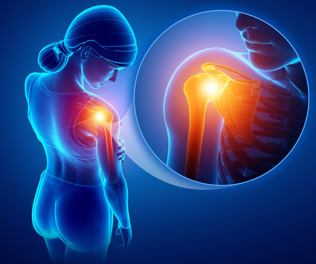 Symptoms And Treatments Of Rotator Cuff Injuries