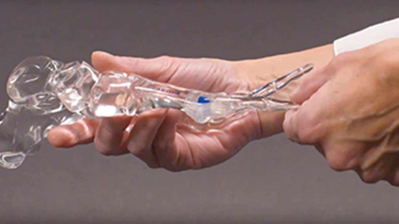 cartiva toe pain baton rouge