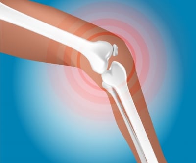 How To Treat One Of The Most Common Causes Of Knee Pain: A Torn Meniscus.