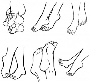 Orthopedics: How Do I Treat Heel Pain?