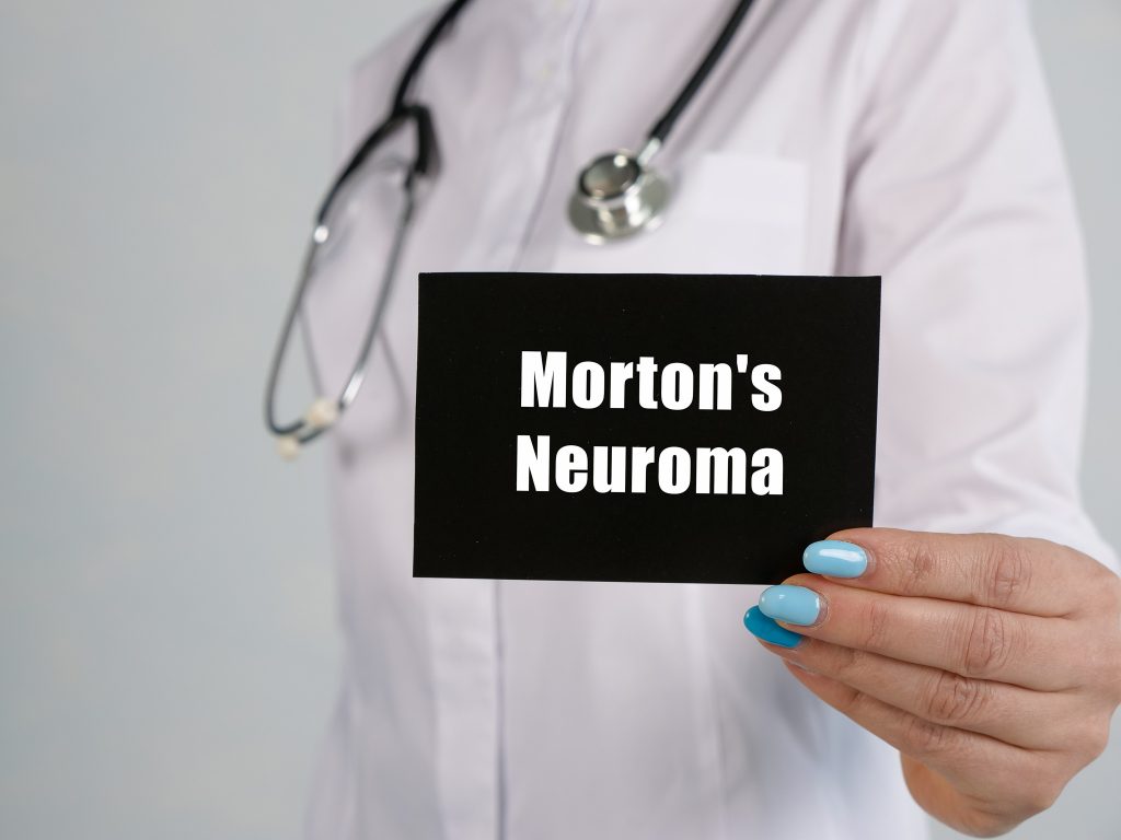 Here’s Everything You Need To Know About Morton’s Neuroma