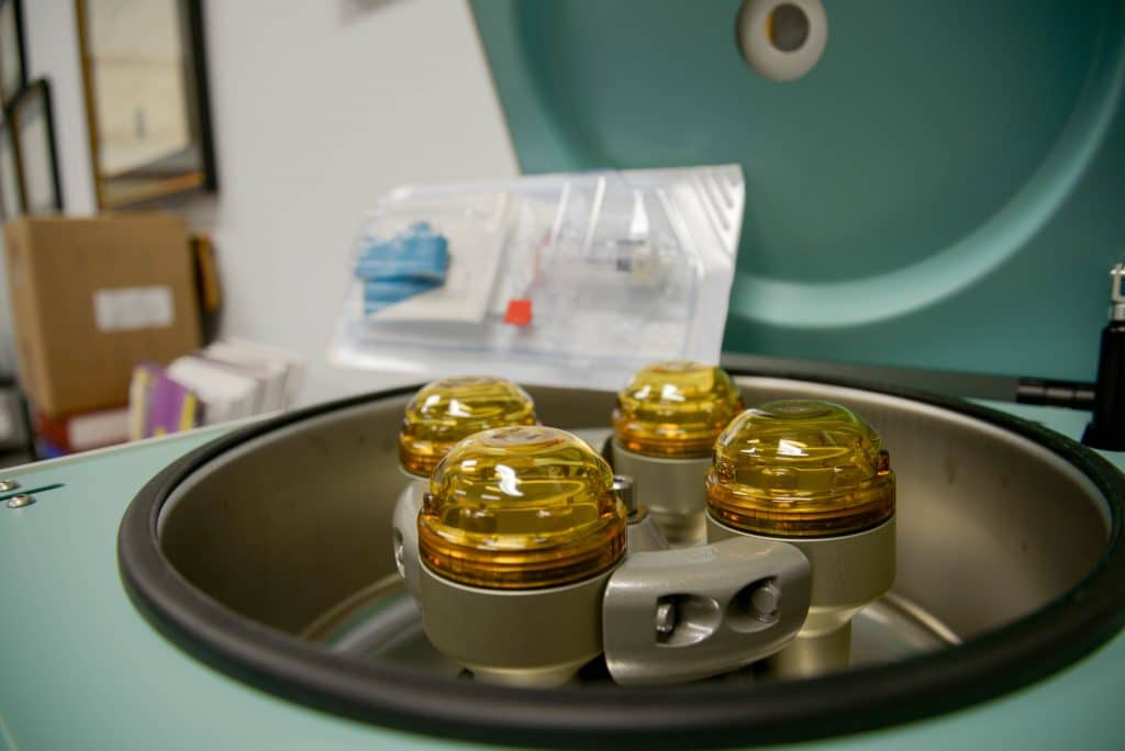 PRP-Platelet Rich Plasma: A Smart Treatment for Sports-Related Ankle Sprains