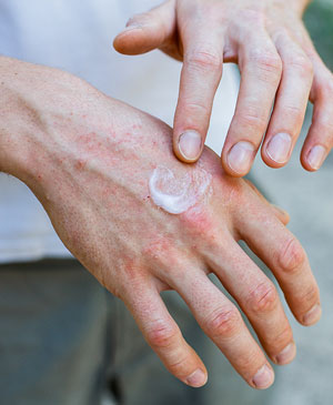 5 Surprising Benefits Of Infrared Sauna Therapy - Skin Health