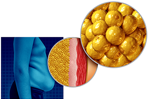 How Weight Loss Improves The Musculoskeletal System - Adipose Tissue