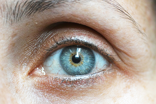 Signs You Need An Omega-3 Supplement - Dry Eye